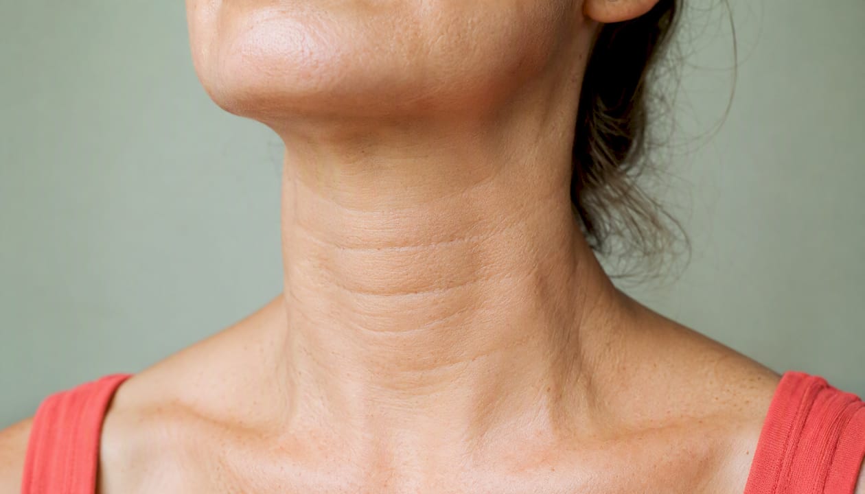 Close-up of horizontal neck lines on skin