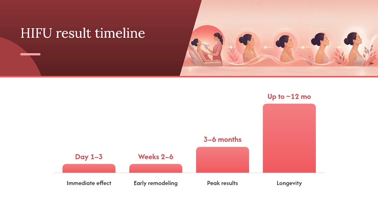 Timeline infographic of HIFU treatment results phases