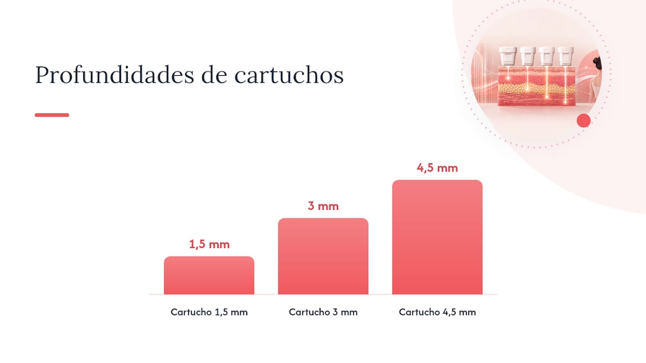 ¿Qué distingue realmente al HIFU coreano de otros enfoques? — overview diagram