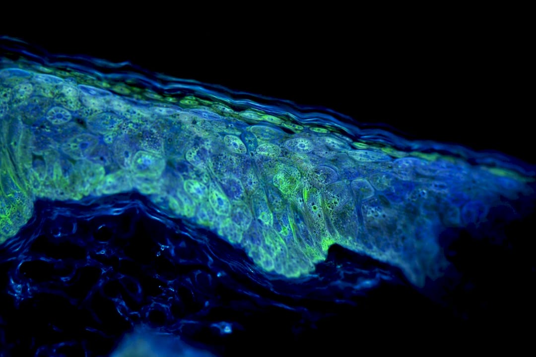 Macro view of illuminated skin cells mitochondria