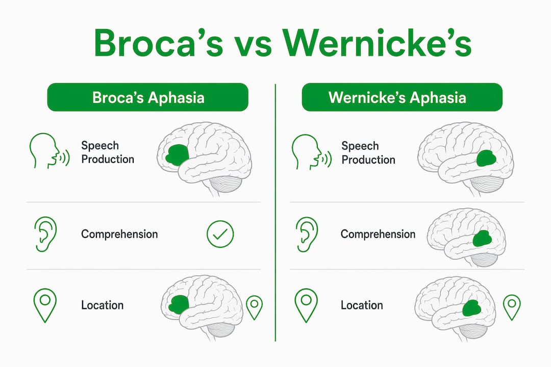 Infographic comparing Broca's and Wernicke's aphasia