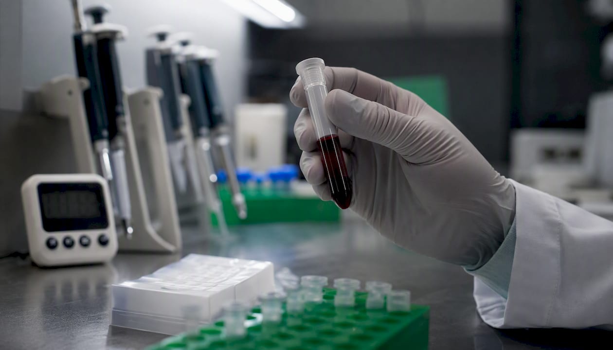 Blood sample tube for pharmacokinetics in lab
