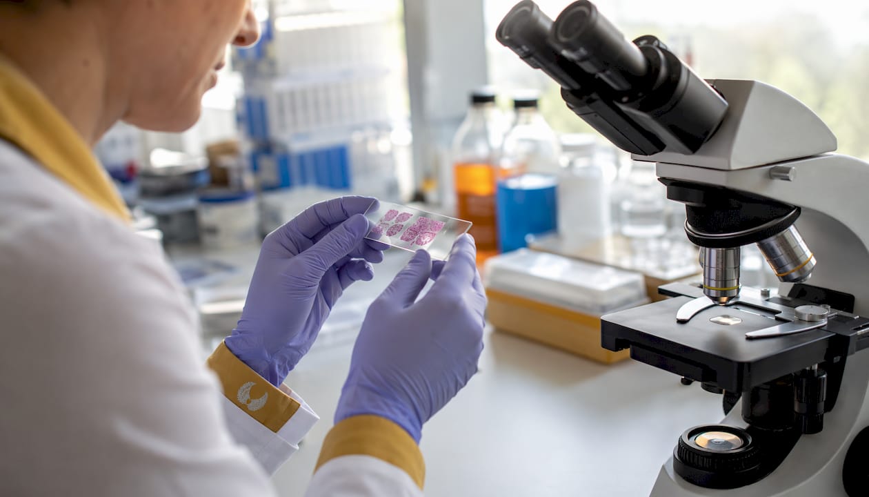 Pathologist holding muscle tumor tissue slide