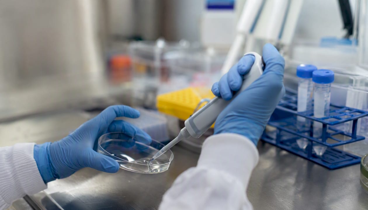 Hands preparing cancer research samples