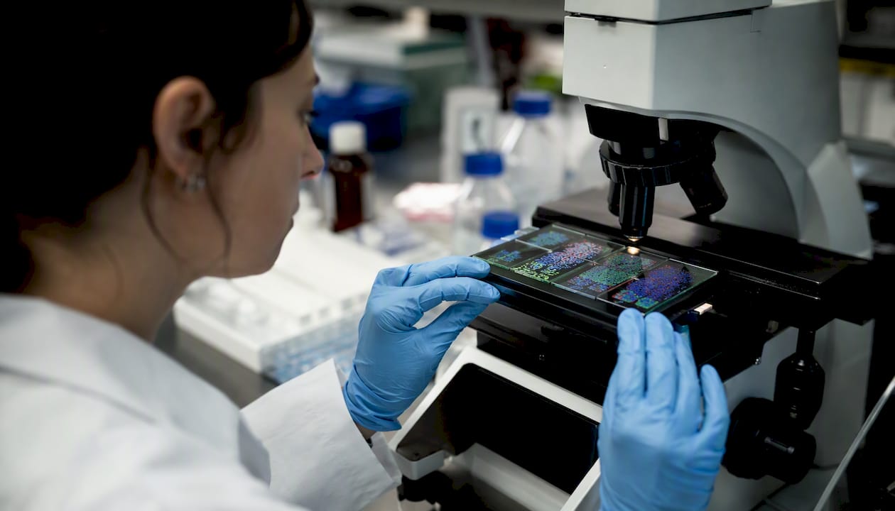 Gloved hands adjusting tumor tissue slides