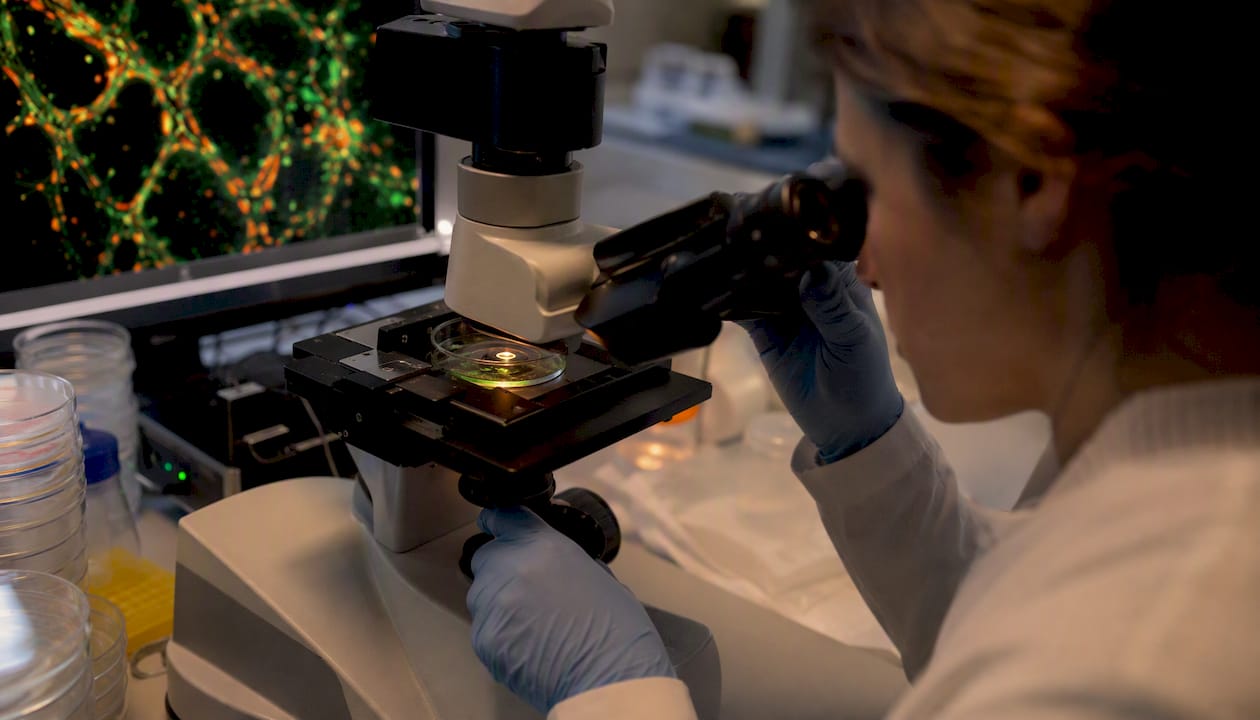 Close-up of tumor lymphatic vessels under microscope