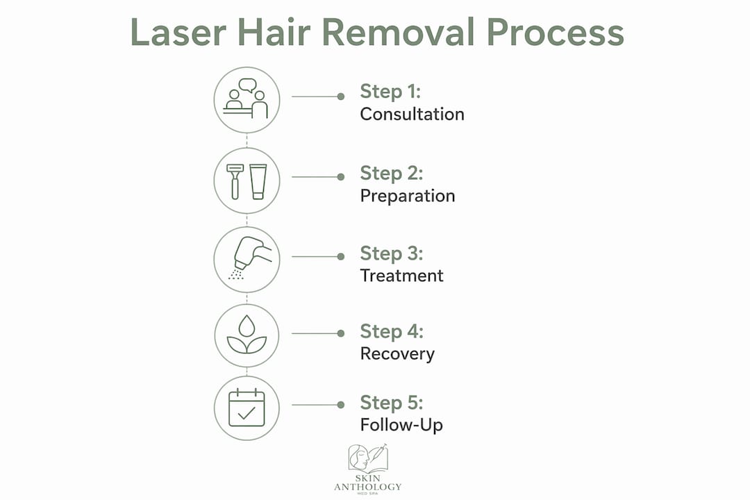Infographic outlining laser hair removal treatment steps