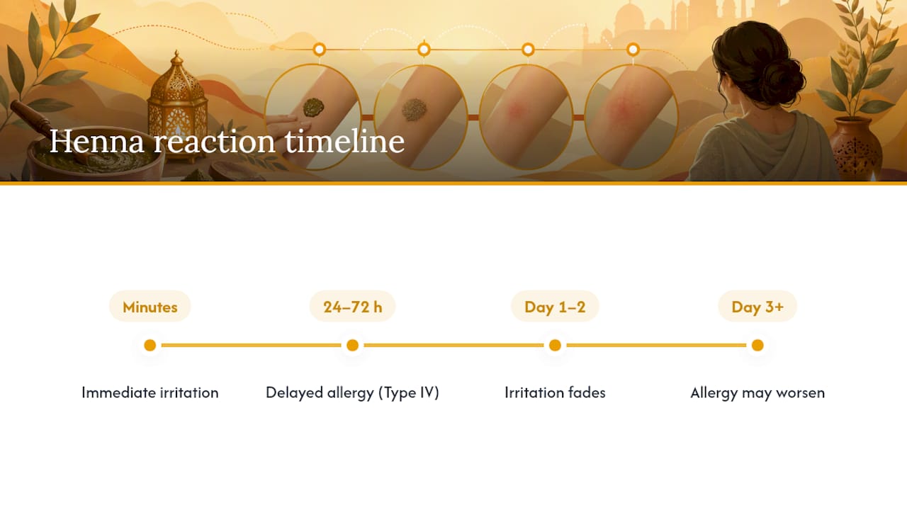 Timeline of immediate and delayed henna reactions