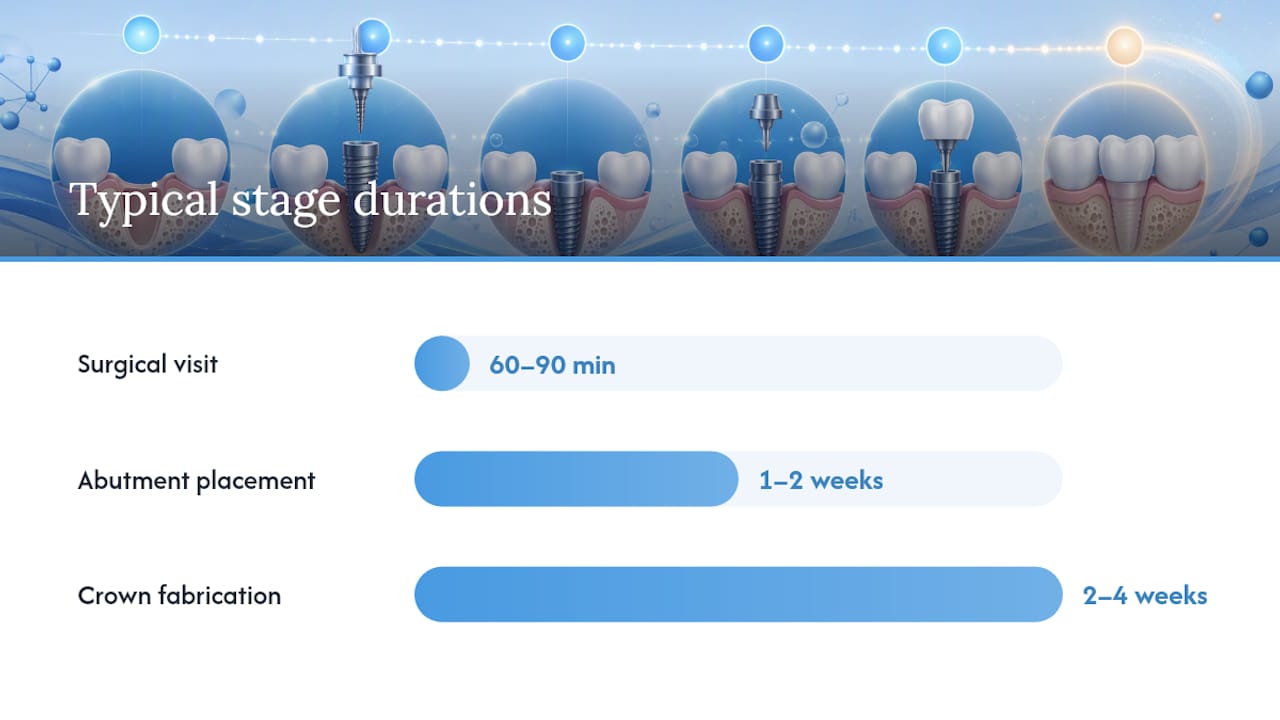 Timeline diagram of single tooth implant stages