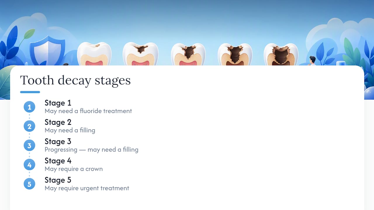 Diagram of the five tooth decay stages and treatments