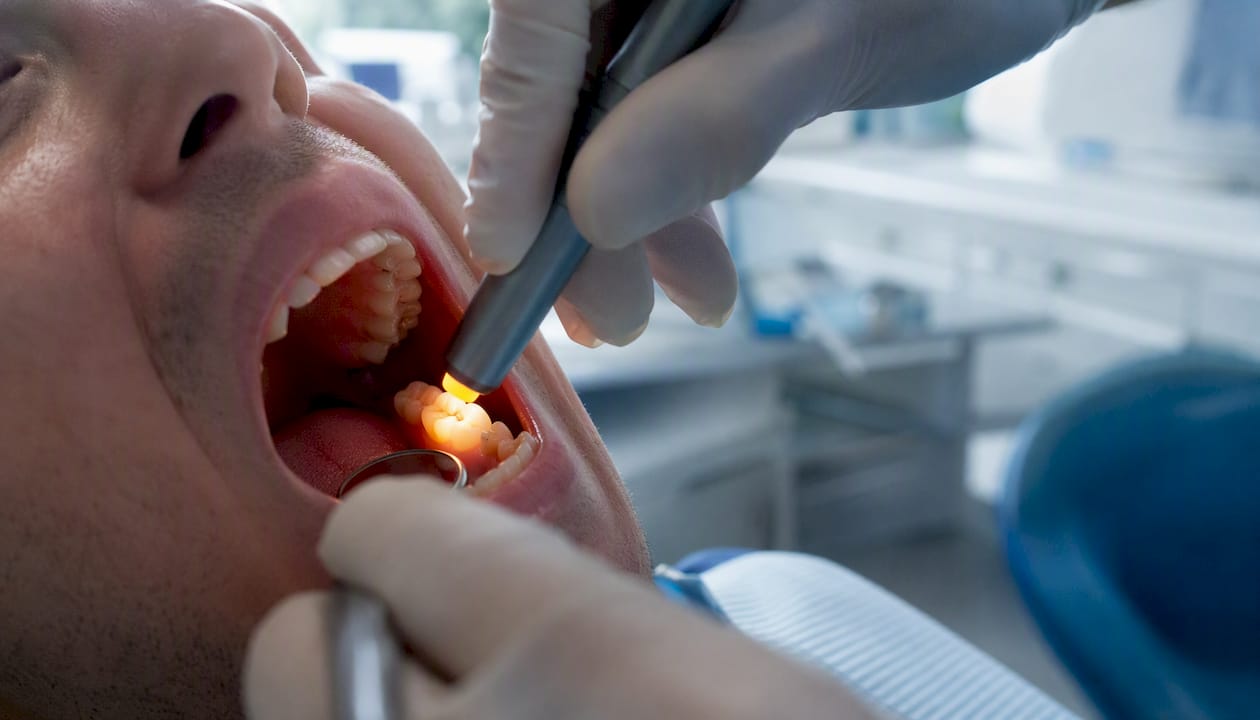 Transillumination light revealing molar tooth crack