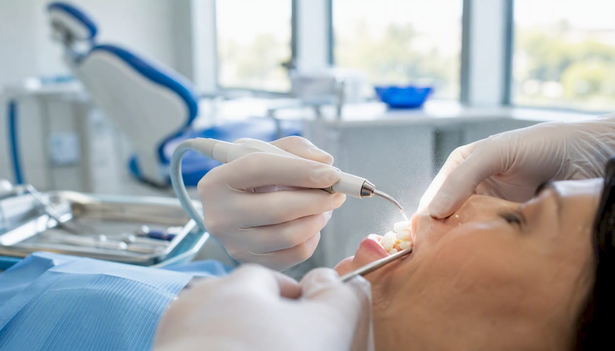 Close-up of dental cleaning with ultrasonic scaler