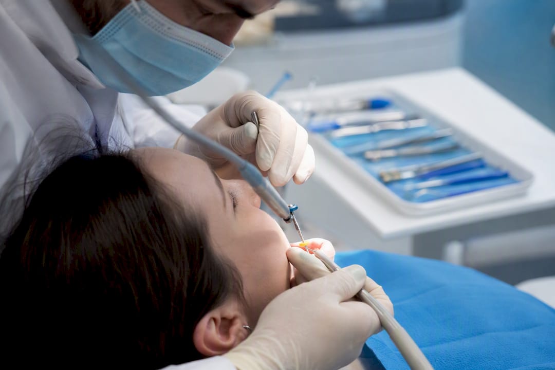 Close-up of root canal dental procedure
