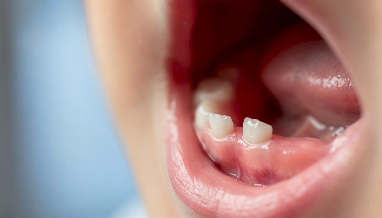 Close-up of healthy baby tooth and gums