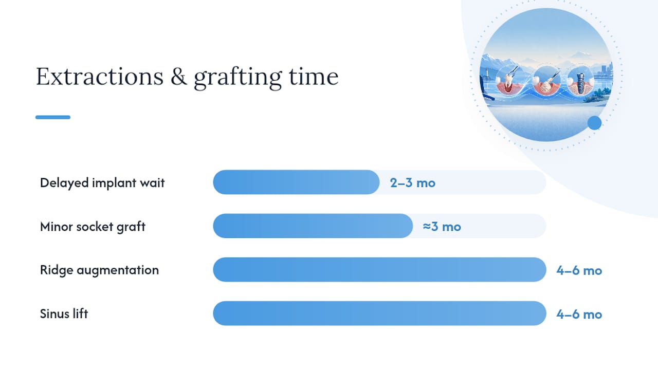 How Do Extractions and Bone Grafting Add Time? — overview diagram