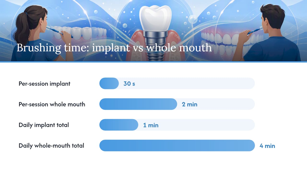 What Daily Dental Implant Maintenance Actually Looks Like — overview diagram