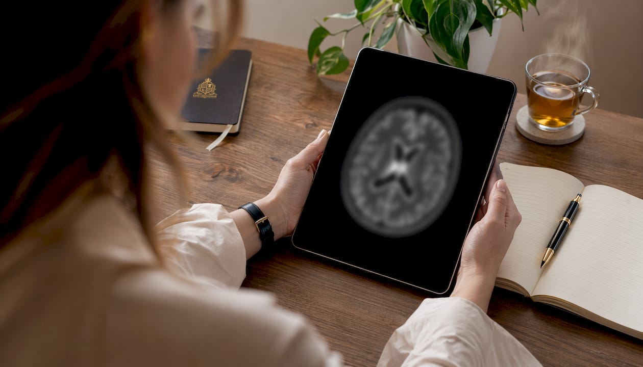 Hands holding tablet with brain scan in research lab