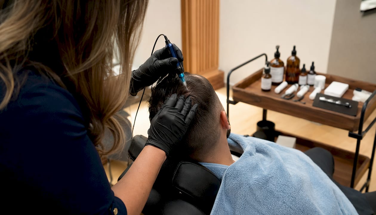 Close-up of scalp microneedling treatment at home