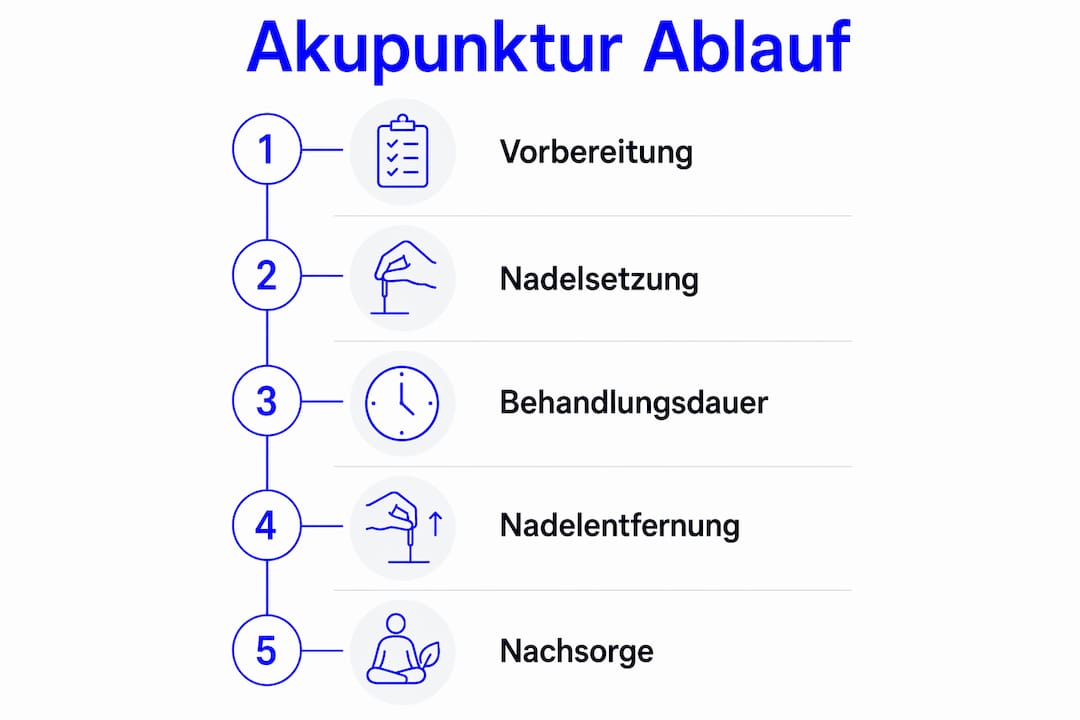 Die Infografik veranschaulicht Schritt für Schritt, wie eine Akupunkturbehandlung abläuft.