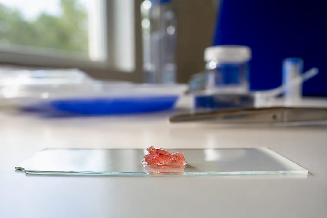 Detailaufnahme einer Gewebeprobe aus der Niere