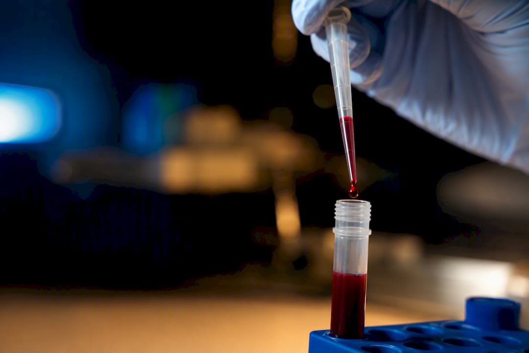 Was heißt Autoimmunkrankheit? Definition und Bedeutung