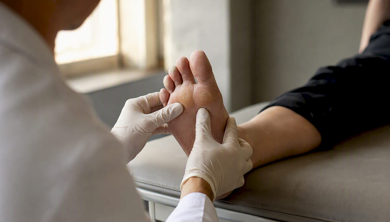 Clinician mapping callus on foot during exam