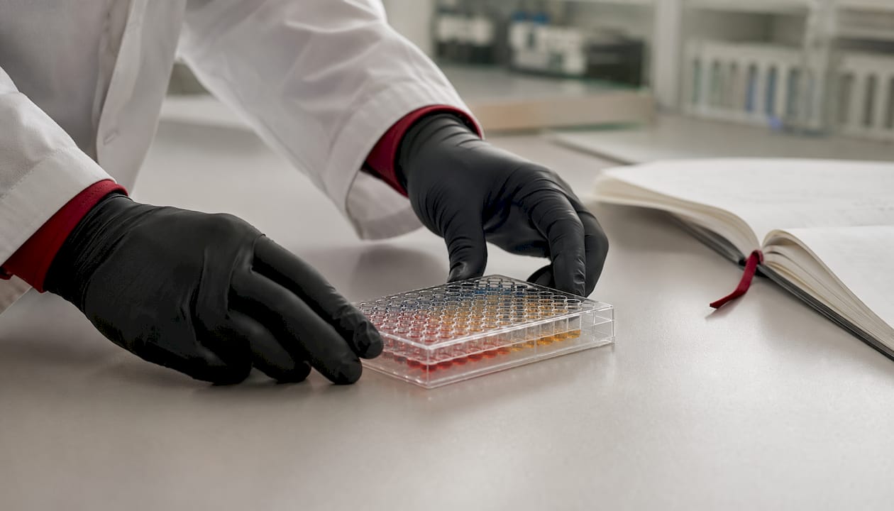 Hands holding microplate assay wells