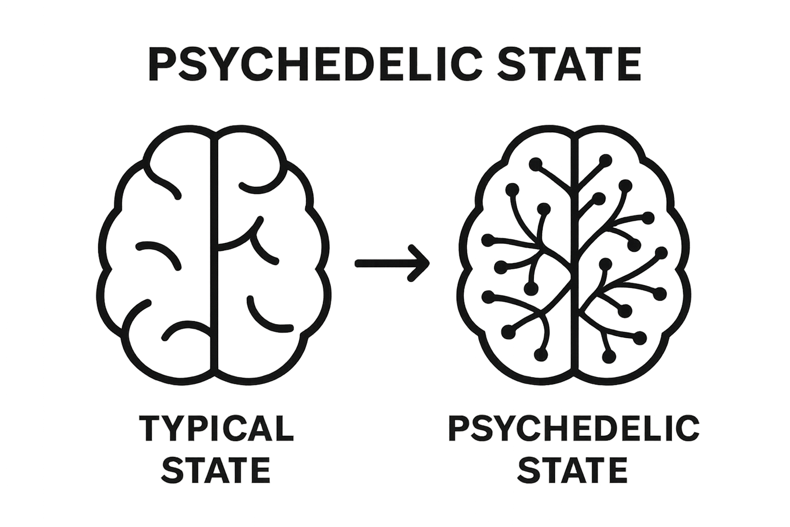Infographic comparing normal and psychedelic brain connectivity