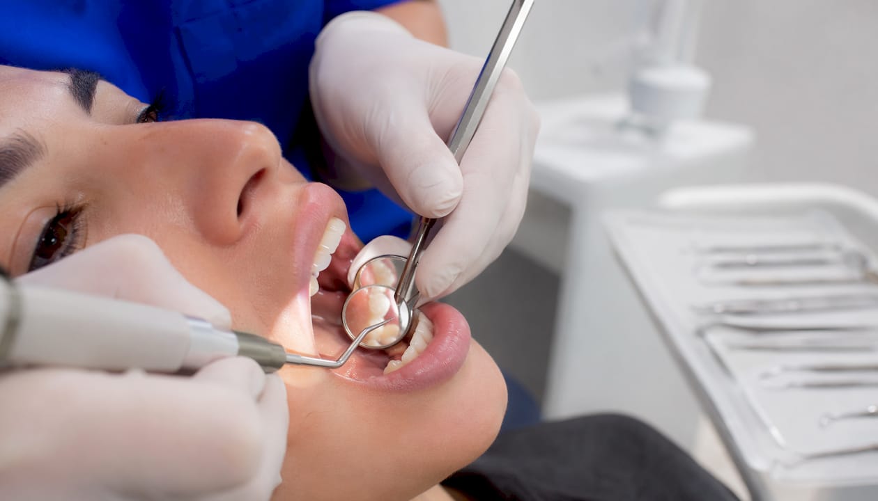 Close-up of scaling dental procedure