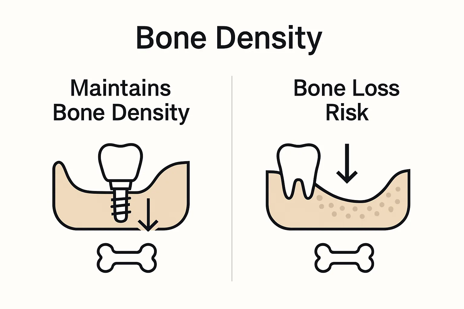 Side-by-side jawbone comparison: with vs. without dental implant