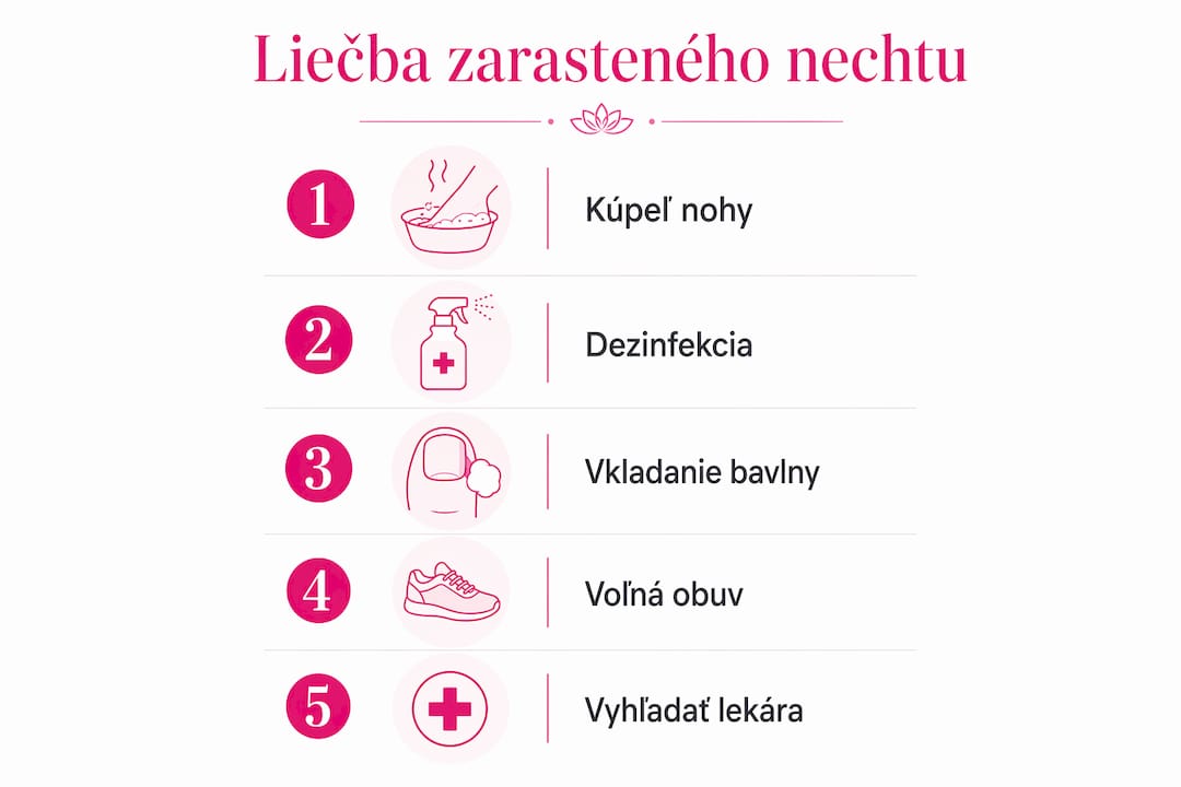 Prehľadný obrázkový návod, ako si doma poradiť so zarasteným nechtom krok za krokom