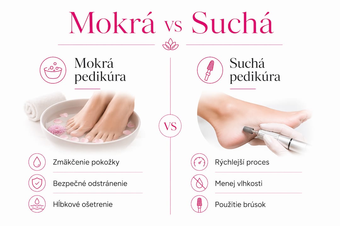 Prehľadná grafika, ktorá ukazuje rozdiely medzi mokrou a suchou pedikúrou