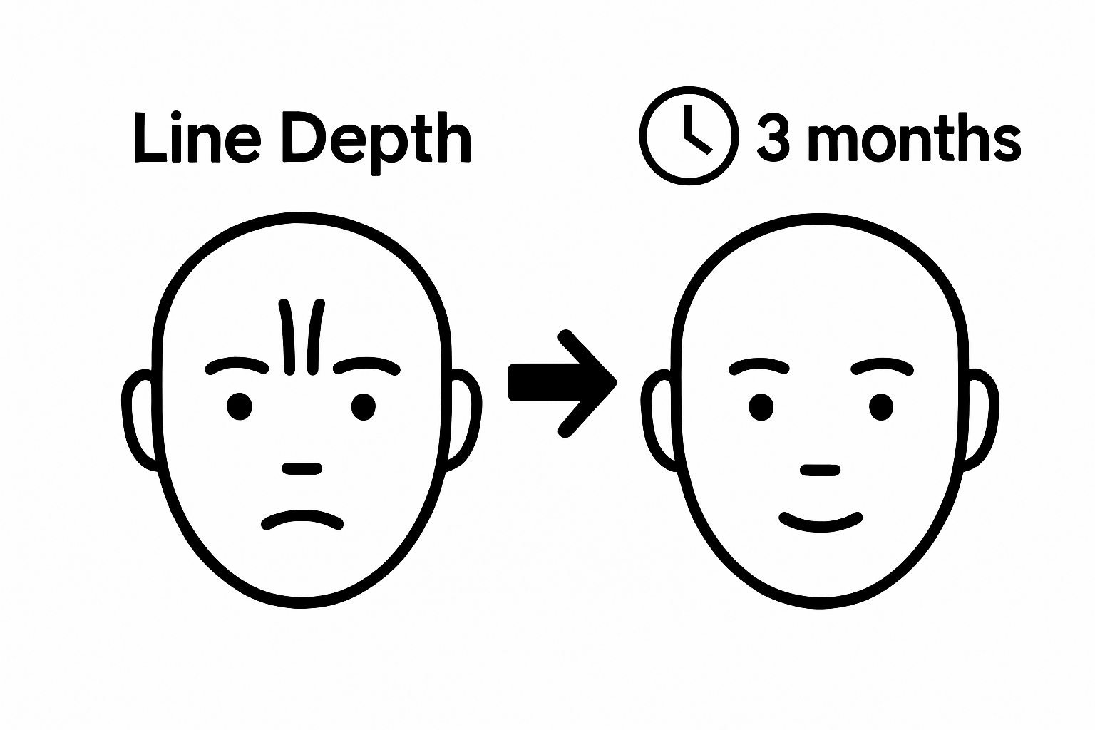 Before and after glabellar lines reduction infographic