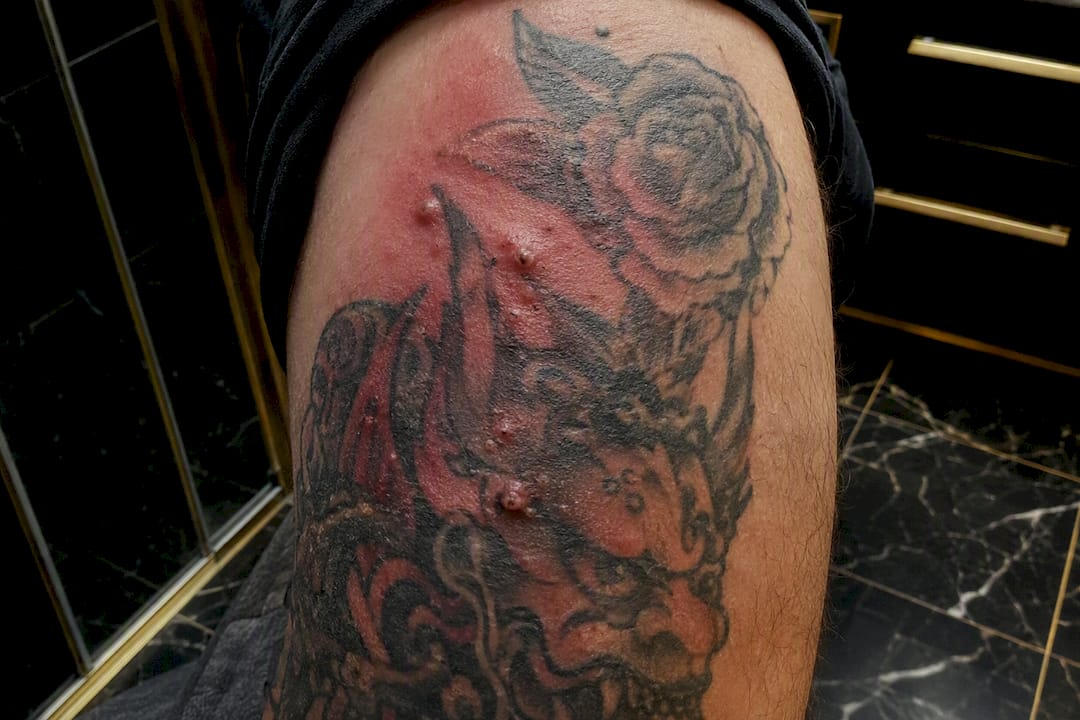 Close-up of irritated tattooed skin showing infection signs