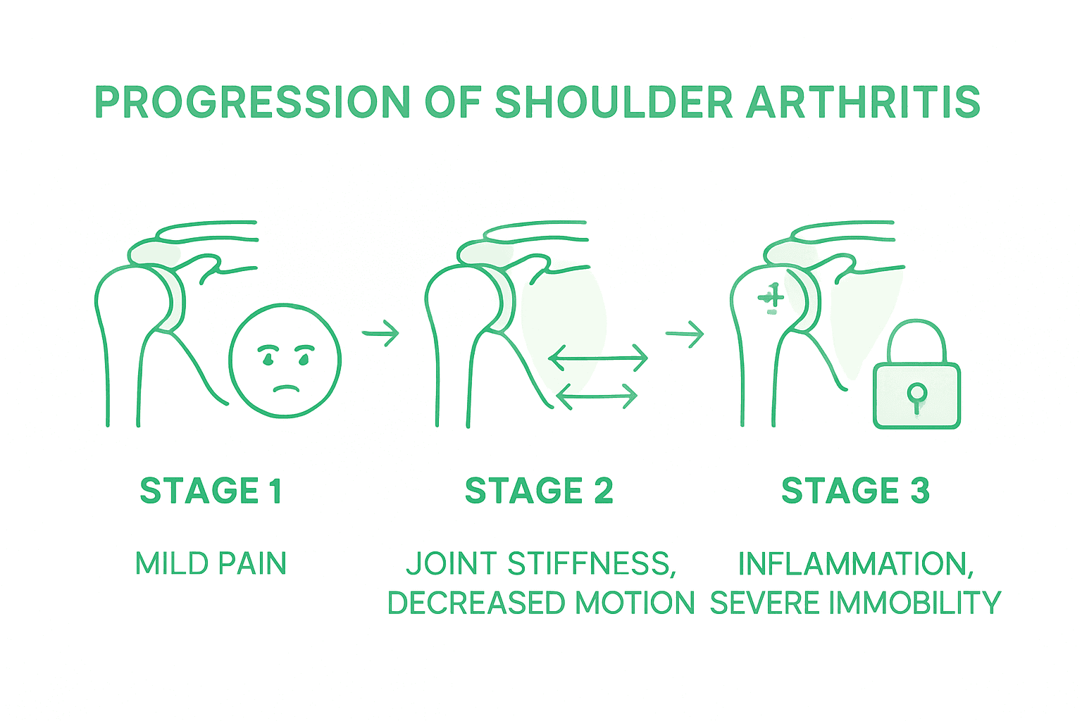 Infographic of shoulder arthritis stages and symptoms