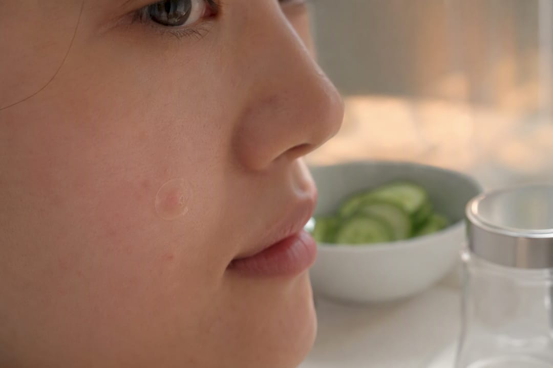 Primo piano di un cerotto per acne come barriera fisica della pelle
