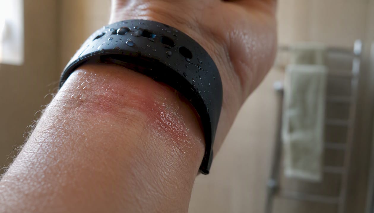 Wer viel schwitzt und dabei regelmäßig ein Armband trägt, kennt das Problem: Unter dem Armband kann sich die Haut leicht entzünden. Gerade in den Sommermonaten oder beim Sport kommt es oft zu Rötungen, Juckreiz oder sogar kleinen Pickeln – eine typische Reaktion auf die Kombination aus Schweiß und eingeschränkter Belüftung.