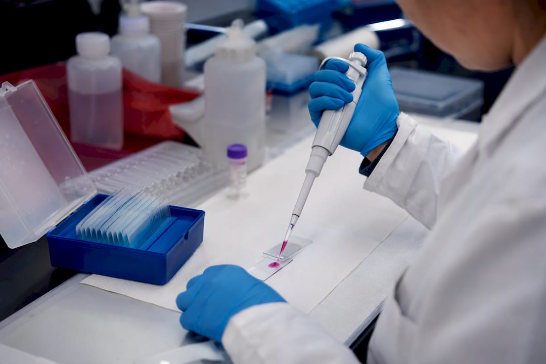 Scientist applying antibody stain to tissue slide