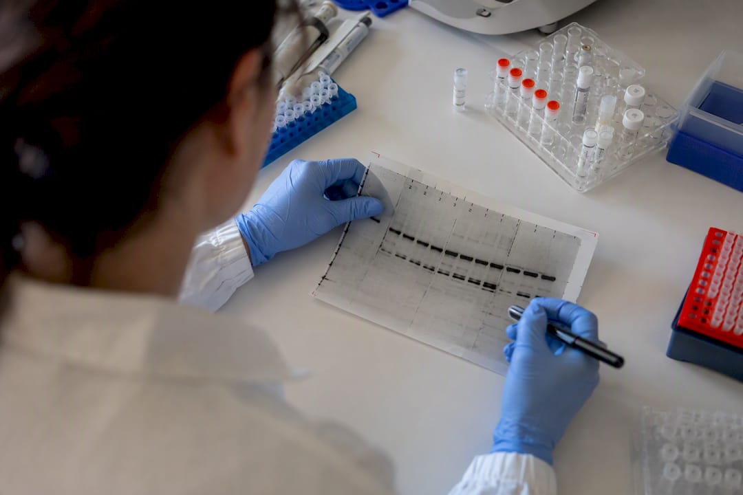Hands holding membrane with blocking buffer test lanes