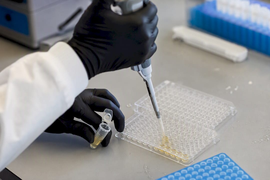 Hands pipetting into assay plate for monoclonal testing