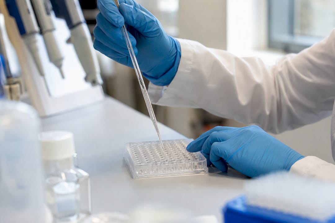 Wissenschaftler pipettiert ELISA-Blockierpuffer