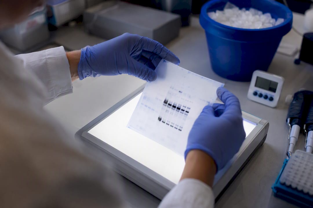 Mains tenant une membrane de western blot éclairée