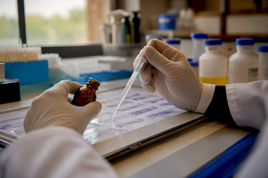 Auftragen des enzymatischen Enzyms auf Gewebeobjektträger