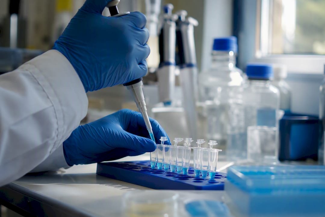 Mit Handschuhen werden Antikörper im Labor pipettiert