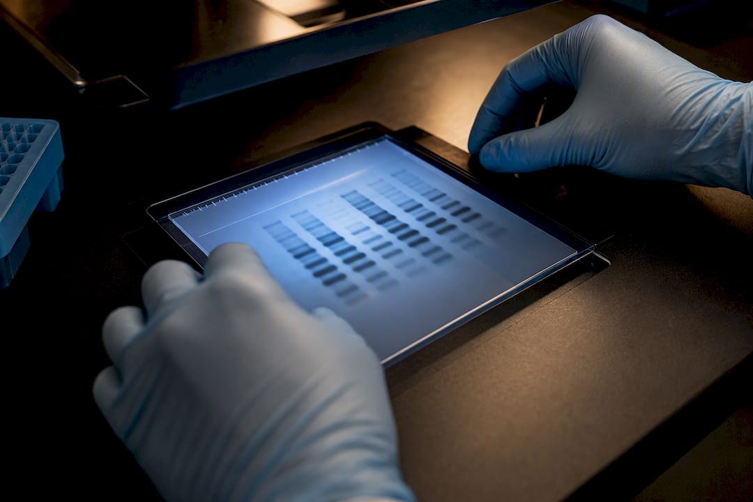 Western blot membrane showing protein bands