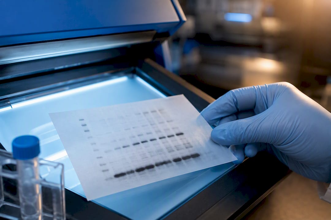 Membrana de western blot con bandas bien definidas