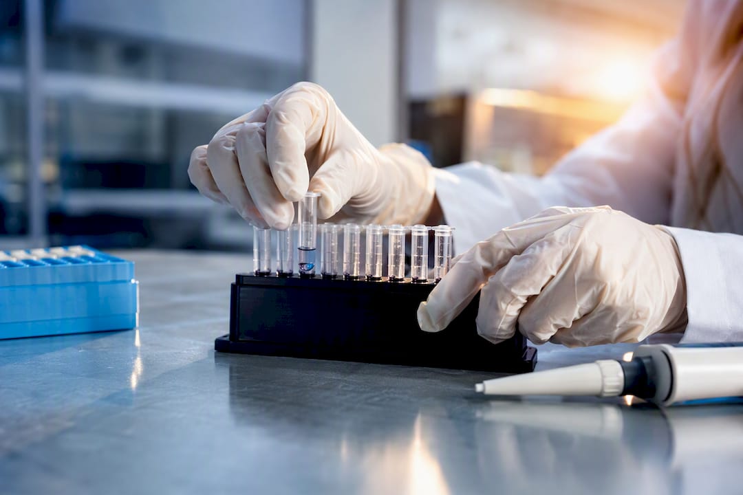 Réalisation d'un test multiplex en laboratoire