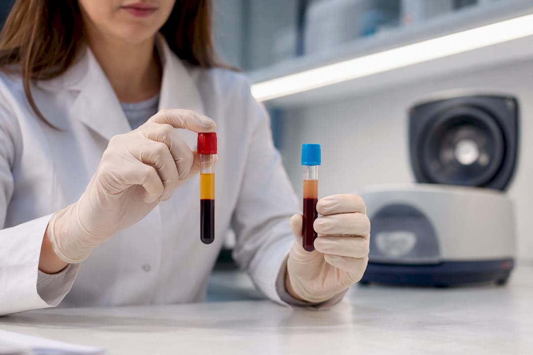 Prélèvements de sérum et de plasma préparés