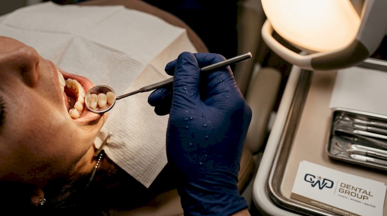 Close-up teeth with plaque and tartar