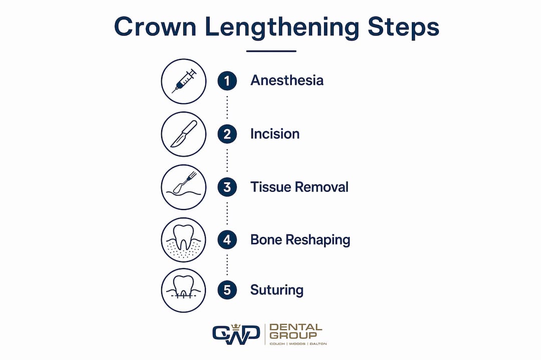 Infographic showing crown lengthening procedure steps